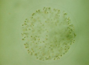 colonie Phaeocystis globosa